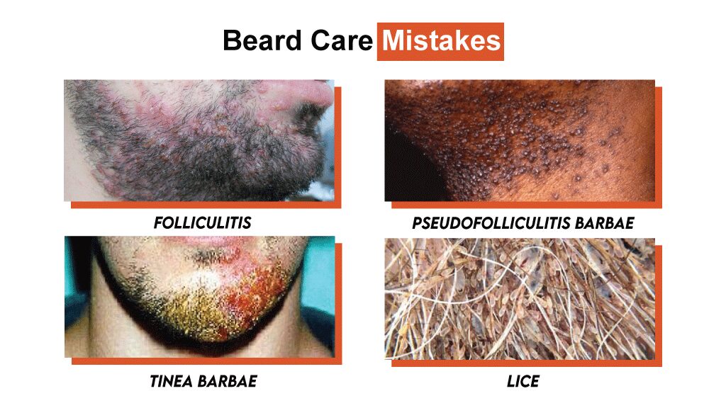 Beard Care Mistakes