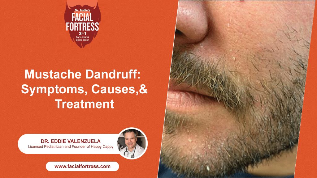 Moustache Dandruff: Causes & Treatment - Facialfortress