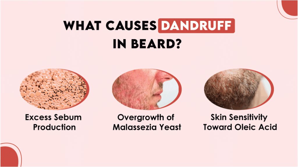 What Causes Dandruff in the Beard