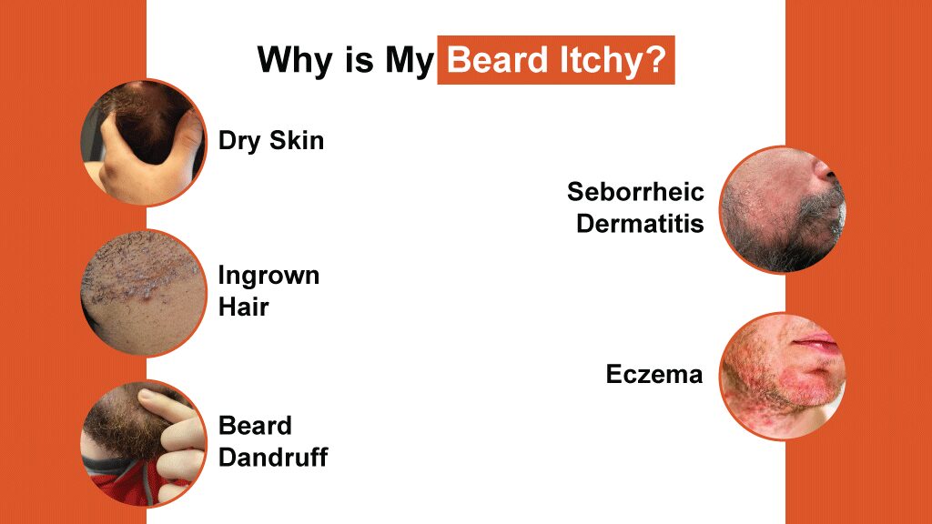 Why is My Beard Itchy