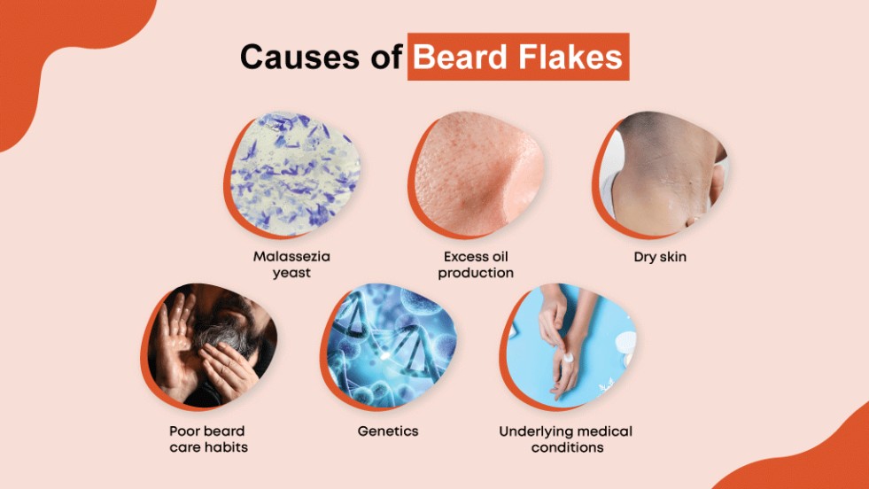 Beardruff from yeast, excess oil, dry skin, weather, poor care, genetics, or medical conditions