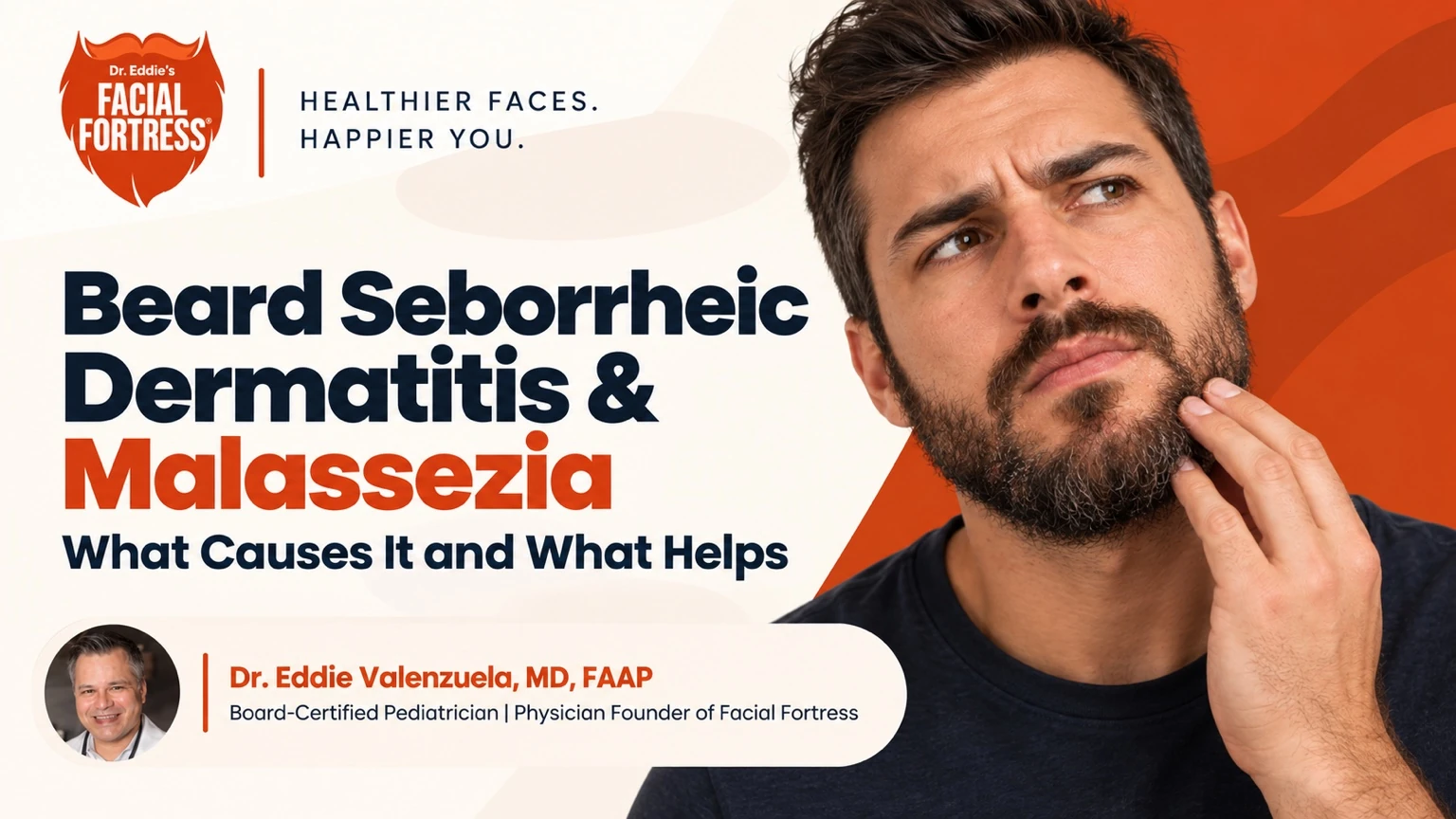 Beard seborrheic dermatitis and Malassezia guide featuring Dr. Eddie Valenzuela and a bearded man with irritated facial skin.