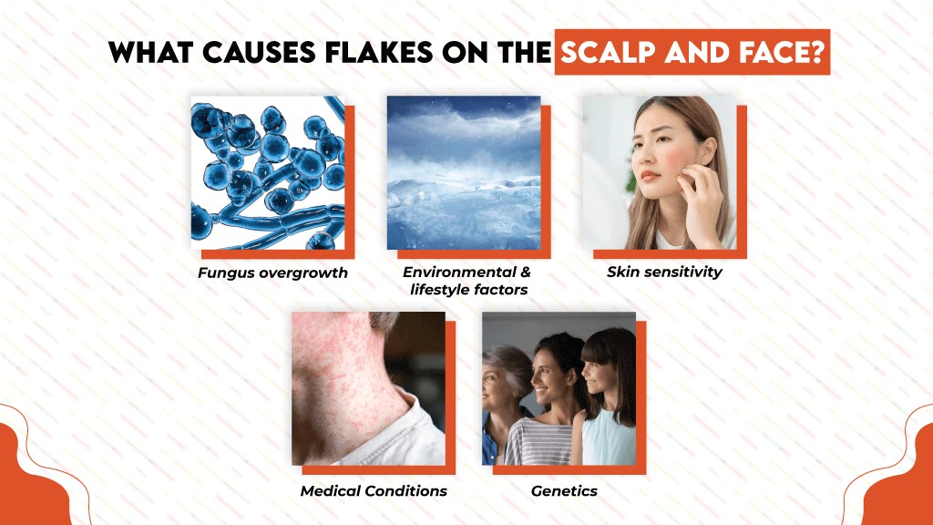 We know that dandruff and seborrheic dermatitis can cause flakes. However, certain factors have been shown to contribute to flakiness and can make the condition worse.