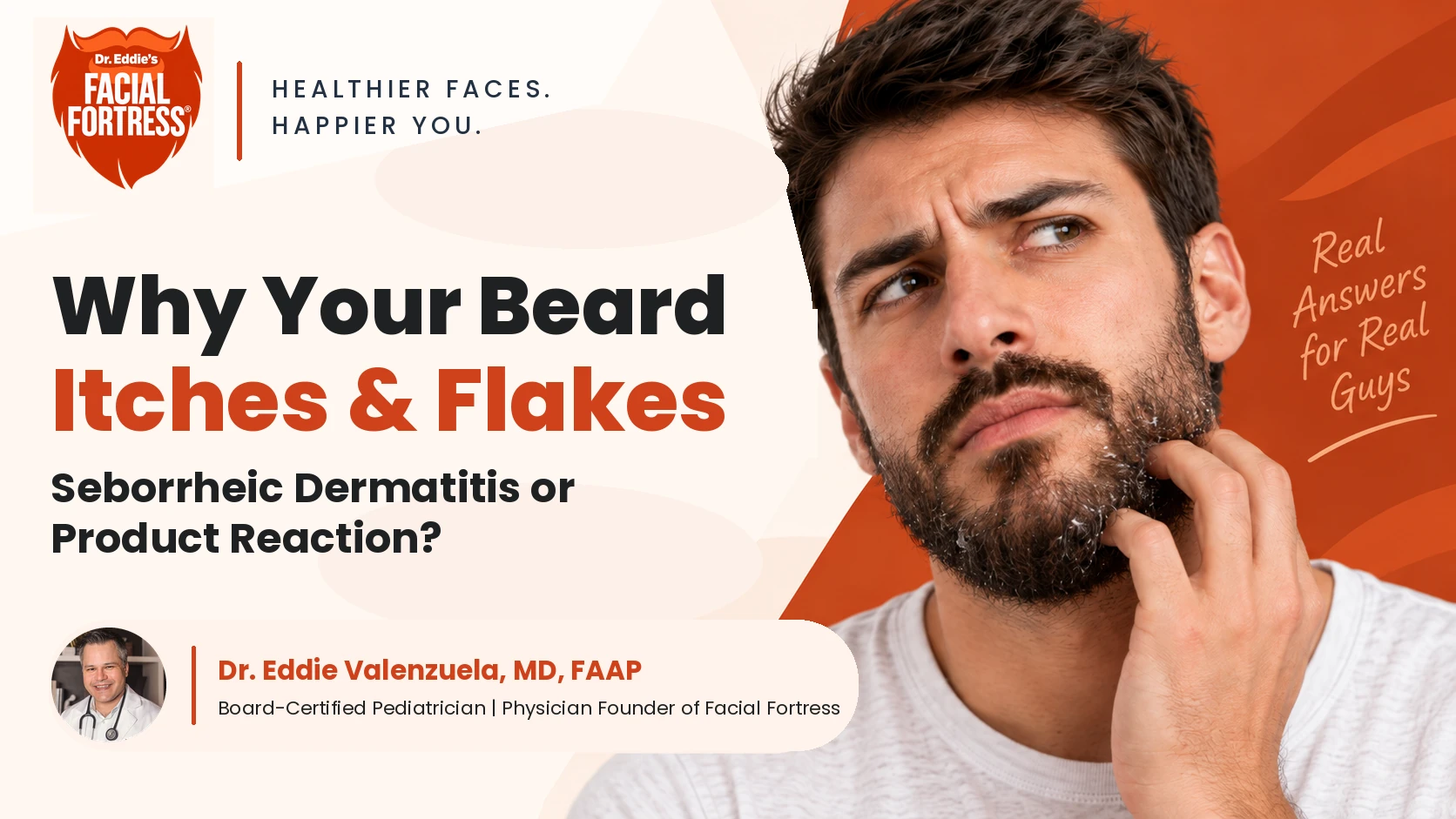 Bearded man with visible beard flakes illustrating seborrheic dermatitis or product reaction, Facial Fortress