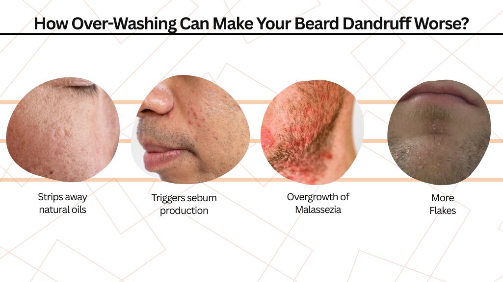 How Over-Washing Can Make Your Beard Dandruff Worse?