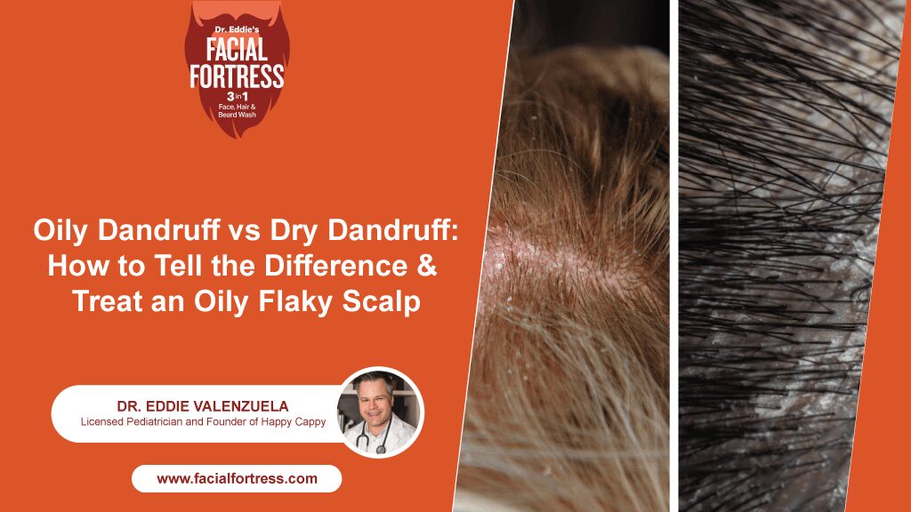 Oily dandruff vs dry dandruff comparison showing how to identify and treat an oily flaky scalp