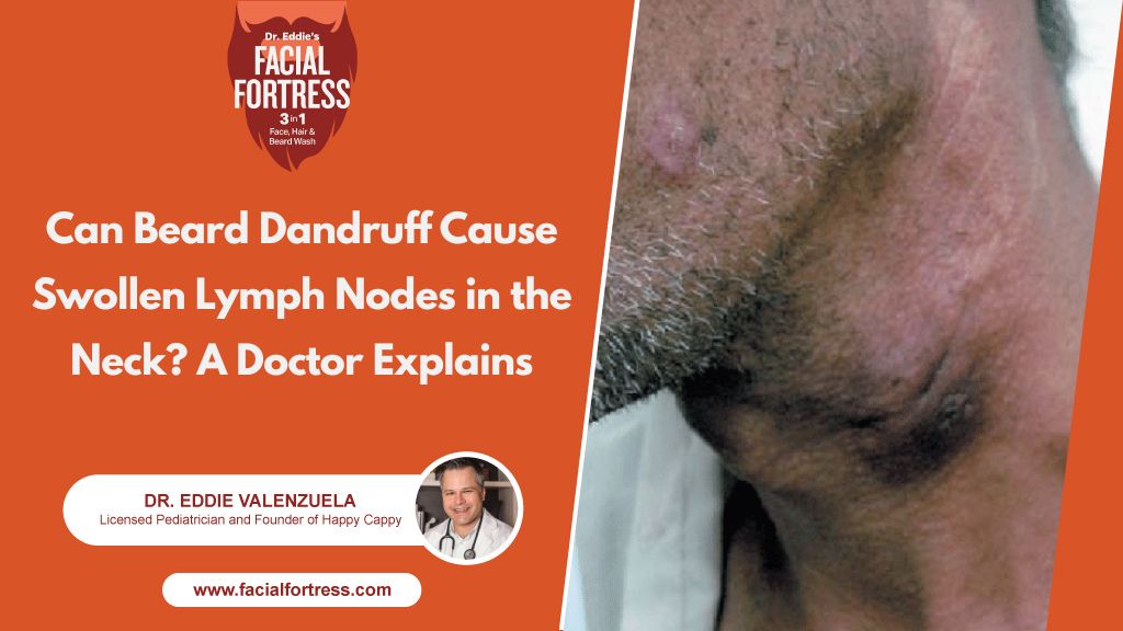 if beard dandruff leads to significant skin irritation, repeated scratching, or secondary bacterial infection, nearby lymph nodes may temporarily enlarge as part of the body’s immune response.