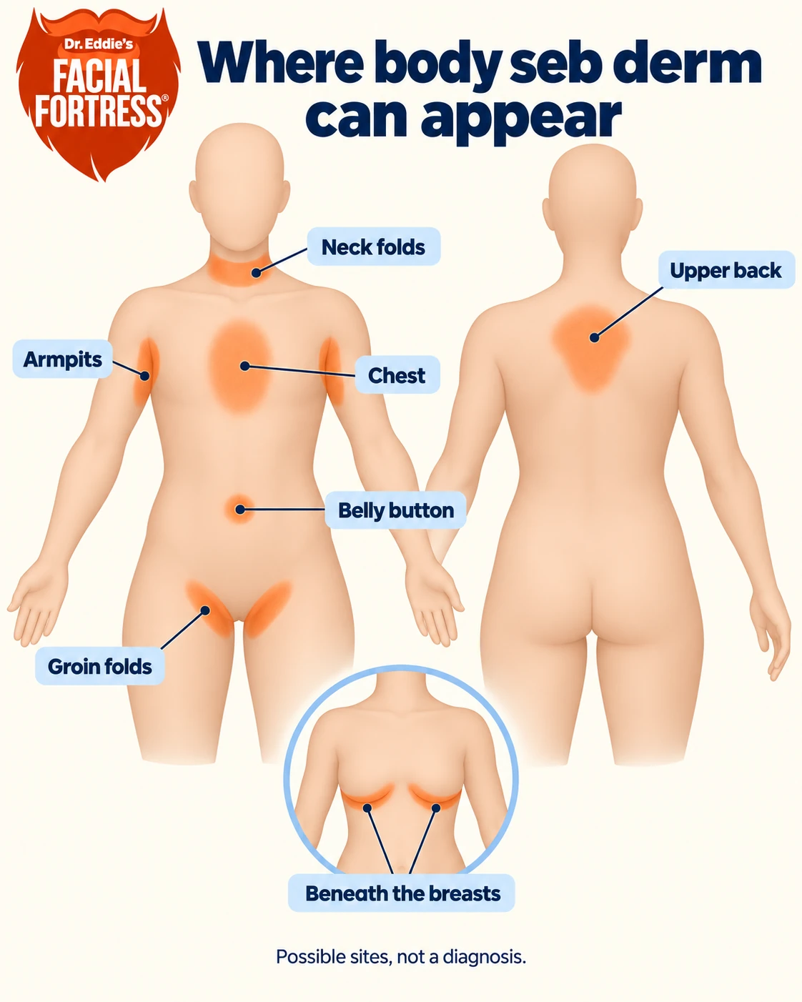 Front and back body diagrams marking the neck folds, armpits, chest, upper back, belly button, groin folds, and skin beneath the breasts.