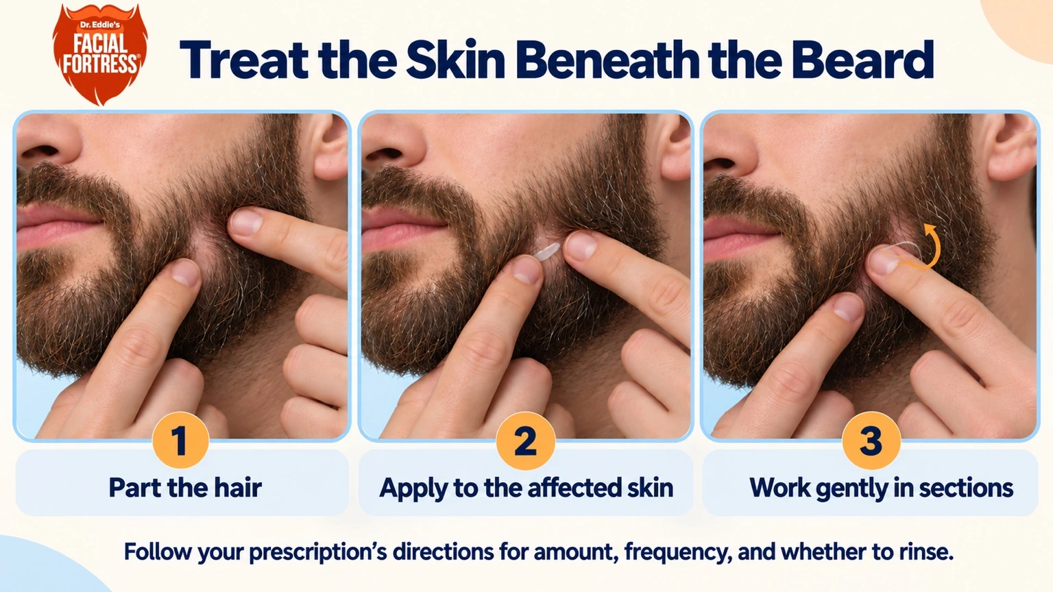 Three steps for applying beard-area treatment: part the hair, apply medicine to the affected skin, and work gently in sections.